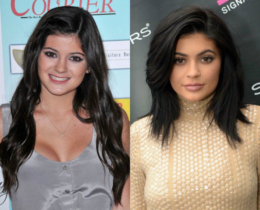 11 celeb, akire szinte rá sem lehet ismerni plasztikai műtétei után -  -  - celebek, műté, plasztikai műtét, plasztikai sebészet, sztárok, 