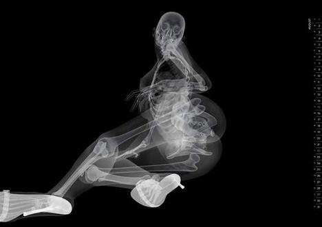 Röntgen erotika -  -  - ++napt%C3%A1r, +2010, EIZO, 