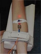 Forradalmian új anti-aging eljárás - Egészség -  - anti-aging, 