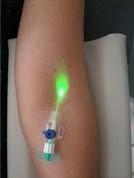 Forradalmian új anti-aging eljárás - Egészség -  - anti-aging, 