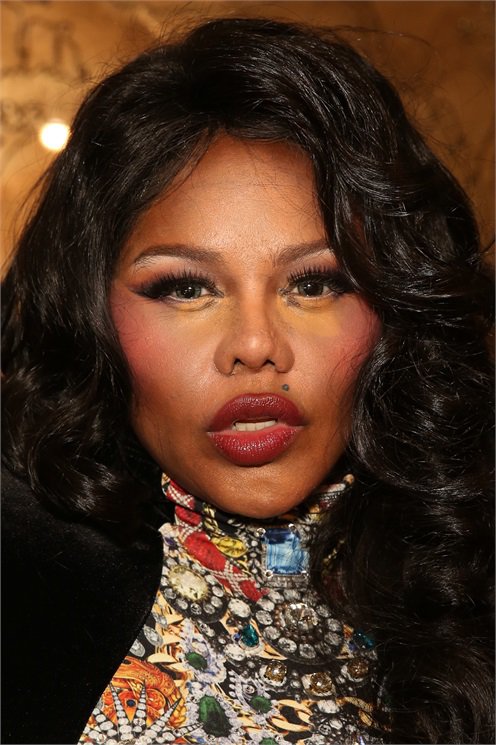 A 20 leghíresebb plasztikai műtét katasztrófa -  -  - celebrity, plasztikai műtét, 