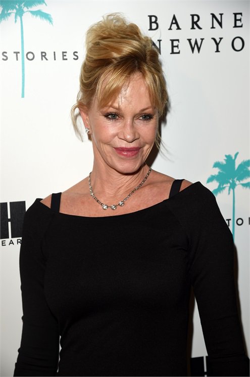 A 20 leghíresebb plasztikai műtét katasztrófa -  -  - celebrity, plasztikai műtét, 