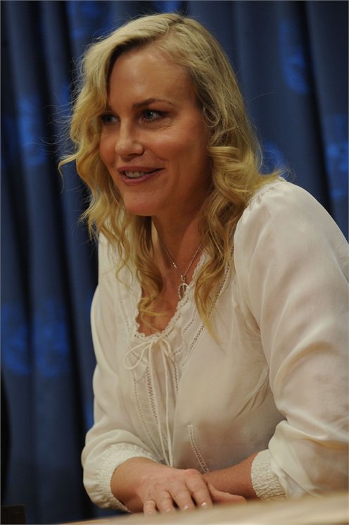 A 20 leghíresebb plasztikai műtét katasztrófa -  -  - celebrity, plasztikai műtét, 