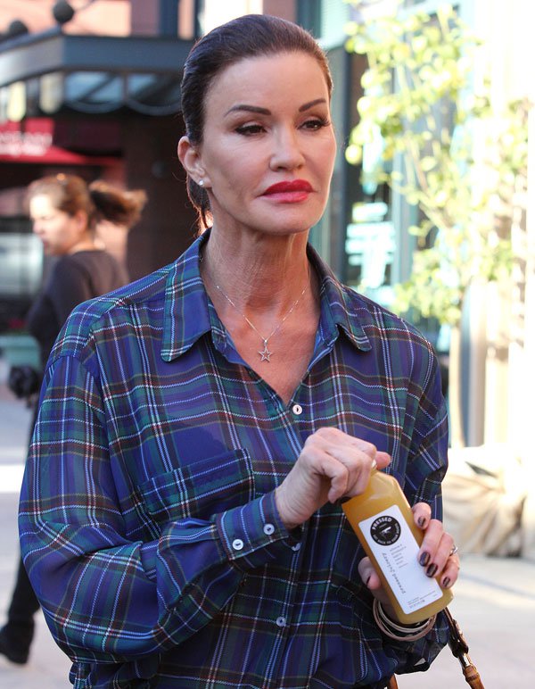 A 20 leghíresebb plasztikai műtét katasztrófa -  -  - celebrity, plasztikai műtét, 