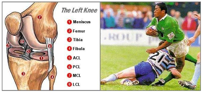 Lábnyújtás gépen - a hatékonyság és a sérülésveszély aspektusából -  -  - edzés, iwi.hu, lábedzés, lábhajlítás, lábnyújtás, 