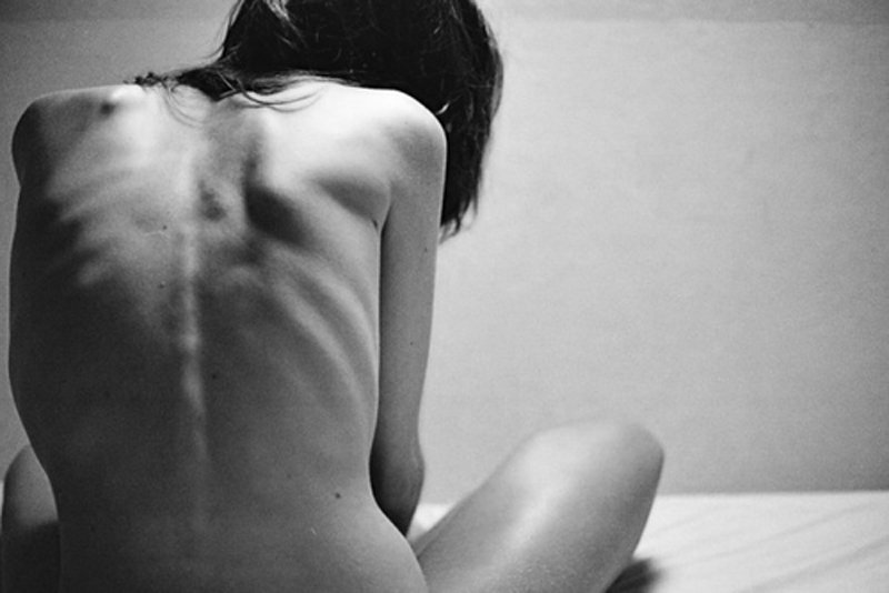 Testem az elmém börtönében - ÉLETÉRZÉS - Mindent egymásért - anorexia, betegség, éhezés, lélek, testképzavar, 